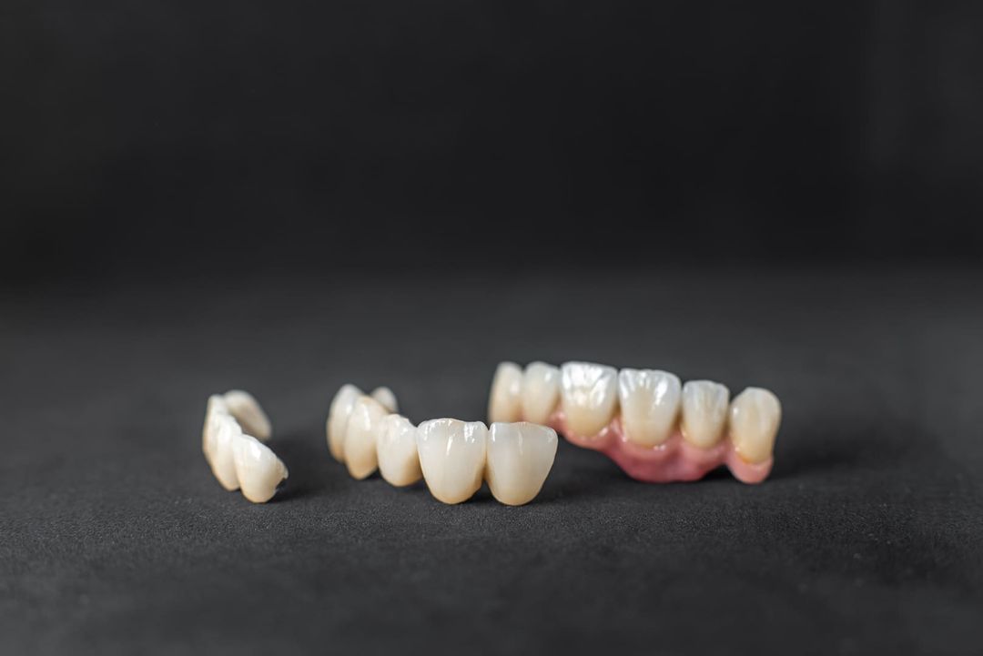 Coroane Dentare